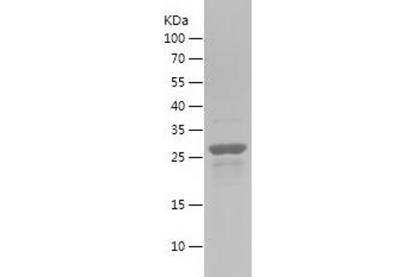 Axin Protein (AA 540-768) (His tag)