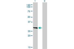Western Blot analysis of FCER1A expression in transfected 293T cell line by FCER1A monoclonal antibody (M01), clone 2C12-3B6. (Fc epsilon RI/FCER1A 抗体  (AA 1-257))