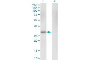 Western Blotting (WB) image for anti-Carbonic Anhydrase I (CA1) (AA 1-261) antibody (ABIN560129)