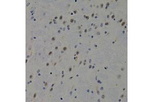 Immunohistochemistry of paraffin-embedded mouse brain using DNMT3B antibody at dilution of 1:200 (400x lens). (DNMT3B 抗体)