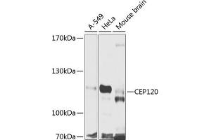 Western blot analysis of extracts of various cell lines, using CEP120 antibody (ABIN6133305, ABIN6138415, ABIN6138416 and ABIN6224025) at 1:1000 dilution. (CEP120 抗体  (AA 1-270))