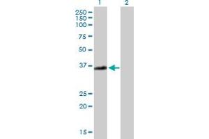 Western Blot analysis of ANXA3 expression in transfected 293T cell line by ANXA3 MaxPab polyclonal antibody. (Annexin A3 抗体  (AA 1-323))