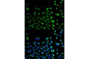 Immunofluorescence analysis of A549 cell using ATG13 antibody. (ATG13 抗体  (AA 281-480))