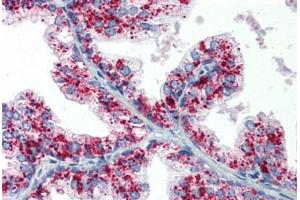 Human Prostate: Formalin-Fixed, Paraffin-Embedded (FFPE) (ASAH1 抗体  (AA 25-125))