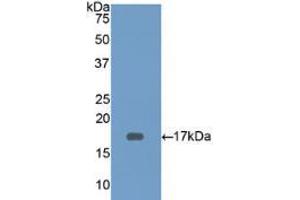 Western blot analysis of recombinant Human CD3d. (CD3D 抗体  (AA 18-113))