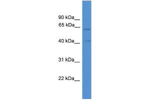 WB Suggested Anti-ACADVL  Antibody Titration: 0. (ACADVL 抗体  (C-Term))