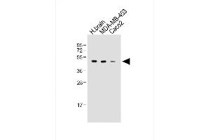 All lanes : Anti-KCNJ13 Antibody (N-term) at 1:2000 dilution Lane 1: Human brain whole tissue lysate Lane 2: MDA-MB-453 whole cell lysate Lane 3: Caco2 whole cell lysate Lysates/proteins at 20 μg per lane. (KCNJ13 抗体  (N-Term))