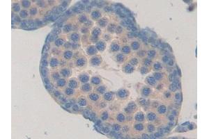 Detection of FBLN1 in Rat Testis Tissue using Polyclonal Antibody to Fibulin 1 (FBLN1) (Fibulin 1 抗体  (AA 127-243))