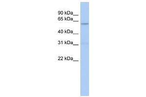 CAMKII antibody used at 1 ug/ml to detect target protein. (CAMKII gamma 抗体  (N-Term))