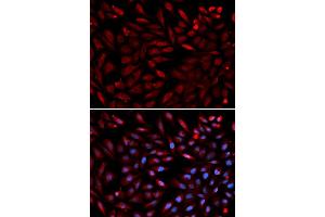 Immunofluorescence analysis of U2OS cells using PSMC2 antibody. (PSMC2 抗体)