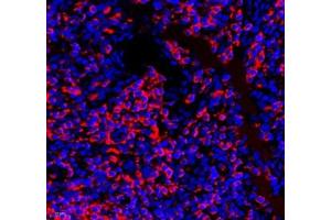 Immunofluorescence of paraffin embedded human tonsil using septin1 (ABIN7074453) at dilution of 1: 650 (400x lens) (LARP1 抗体)