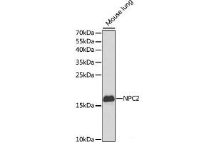 Western blot analysis of extracts of Mouse lung using NPC2 Polyclonal Antibody at dilution of 1:1000. (NPC2 抗体)