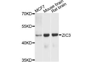 Western blot analysis of extracts of various cells, using ZIC3 antibody. (ZIC3 抗体)