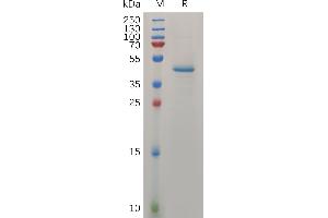 SDS-PAGE (SDS) image for Midkine (Neurite Growth-Promoting Factor 2) (MDK) (AA 21-143) protein (Fc Tag) (ABIN7490871)