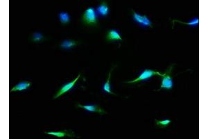 Immunofluorescence staining of U251 cells with ABIN7158941 at 1:133, counter-stained with DAPI. (MDH1 抗体  (AA 1-334))