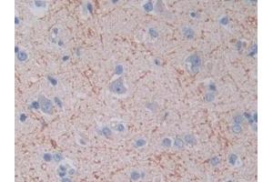 Immunohistochemistry (IHC) image for anti-Topoisomerase (DNA) III alpha (TOP3A) (AA 35-179) antibody (ABIN7435616)