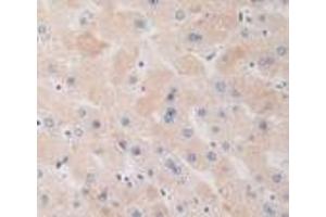 Detection of DRD1 in Human Liver Tissue using Polyclonal Antibody to Dopamine Receptor D1 (DRD1) (Dopamine Receptor d1 抗体  (AA 338-446))