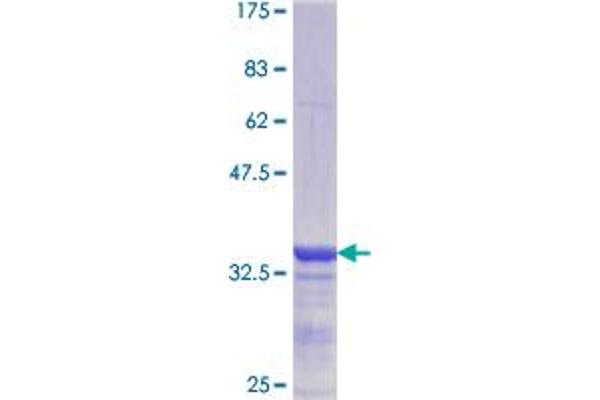 CBS Protein (AA 173-270) (GST tag)