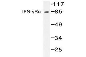 Western blot analyzes of IFNGRA antibody in extracts from COS7 cells. (IFNGR1 抗体)