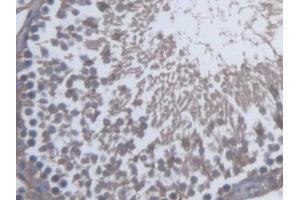 DAB staining on IHC-P; Samples: Rat Testis Tissue (SKAP1 抗体  (AA 1-354))