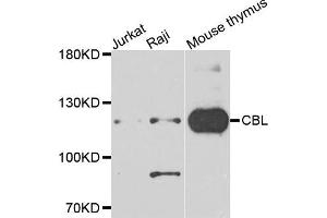 Western blot analysis of extracts of various cells, using CBL antibody. (CBL 抗体)