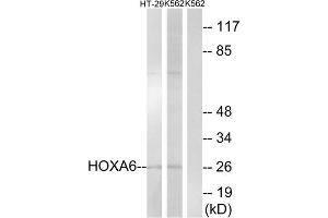 Western blot analysis of extracts from HT-29 cells and K562 cells, using HOXA6 antibody. (HOXA6 抗体  (Internal Region))