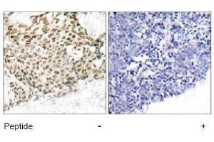 Image no. 1 for anti-Nibrin (NBN) (Ser343) antibody (ABIN197201) (Nibrin 抗体  (Ser343))