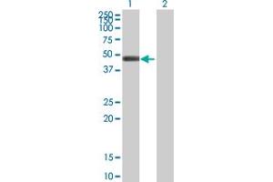Western Blot analysis of GCDH expression in transfected 293T cell line by GCDH MaxPab polyclonal antibody. (GCDH 抗体  (AA 1-438))
