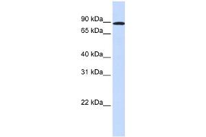 WB Suggested Anti-MYBL1 Antibody Titration:  0. (MYBL1 抗体  (Middle Region))