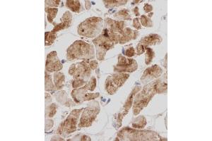 Immunohistochemical analysis of TITIN in Human heart tissue sections(IHC-P - paraformaldehyde-fixed, paraffin-embedded sections). (Titin 抗体  (N-Term))