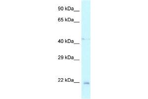 WB Suggested Anti-Twist1 Antibody Titration: 1. (TWIST1 抗体  (N-Term))