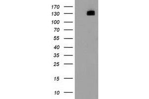 Western Blotting (WB) image for anti-Histone Deacetylase 6 (HDAC6) antibody (ABIN1498619) (HDAC6 抗体)