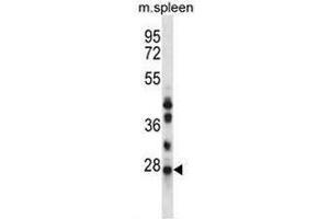 NQO2 Antibody (N-term) western blot analysis in mouse spleen tissue lysates (35µg/lane). (NQO2 抗体  (N-Term))
