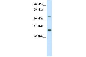 WB Suggested Anti-SPZ1 Antibody Titration:  2. (SPZ1 抗体  (C-Term))