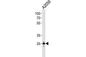 Western Blotting (WB) image for anti-Mitochondrial Ribosomal Protein L28 (MRPL28) antibody (ABIN3000729) (MRPL28 抗体)