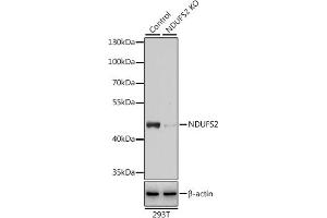 Western blot analysis of extracts from normal (control) and NDUFS2 knockout (KO) 293T cells, using NDUFS2 antibody (ABIN6133022, ABIN6144484, ABIN6144485 and ABIN7101413) at 1:3000 dilution. (NDUFS2 抗体  (AA 204-463))