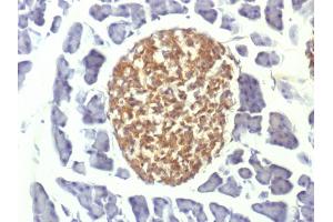 Immunohistochemistry (IHC) image for anti-Enolase 2 (Gamma, Neuronal) (ENO2) (AA 416-433) antibody (ABIN6939308)
