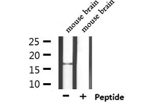 Western blot analysis of extracts from mouse brain, using CALML3 Antibody. (CALML3 抗体  (Internal Region))