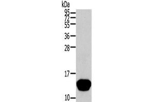 Western Blot analysis of Human normal liver tissue using THRSP Polyclonal Antibody at dilution of 1/400 (THRSP 抗体)