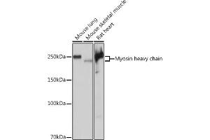 Western blot analysis of extracts of various cell lines, using Myosin heavy chain Rabbit mAb (ABIN7268750) at 1:5000 dilution. (MYH7 抗体)