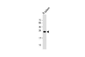 Anti-LIF Antibody (Center) at 1:1000 dilution + Rat spleen lysate Lysates/proteins at 20 μg per lane. (LIF 抗体  (AA 72-101))