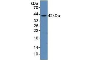 Detection of Recombinant aHSP, Rat using Polyclonal Antibody to Alpha-Hemoglobin Stabilizing Protein (aHSP) (aHSP 抗体  (AA 2-102))