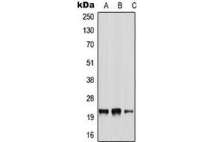 Western blot analysis of NRSN2 expression in A549 (A), NIH3T3 (B), H9C2 (C) whole cell lysates. (NRSN2 抗体  (Center))