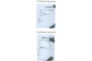 anti-sigma 54 antibody