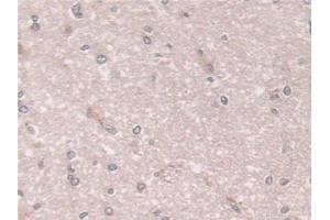 Immunohistochemistry (IHC) image for anti-Coxsackie Virus and Adenovirus Receptor (CXADR) (AA 20-229) antibody (ABIN7441556)