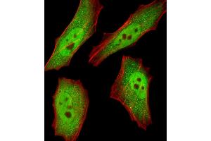 Fluorescent image of HeLa cells stained with RBX1 Antibody . (RBX1 抗体  (C-Term))