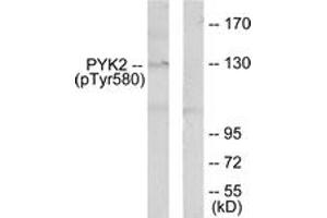 Western blot analysis of extracts from K562 cells, using PYK2 (Phospho-Tyr580) Antibody.