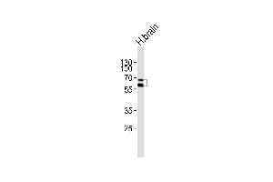 Western blot analysis of lysate from human brain tissue lysate, using NR4A2 Antibody (Center) (ABIN6243918 and ABIN6577859).