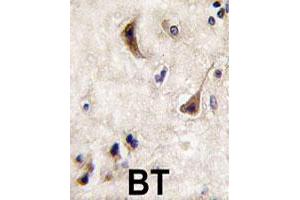Formalin-fixed and paraffin-embedded human brain tissue reacted with PTPN5 polyclonal antibody  , which was peroxidase-conjugated to the secondary antibody, followed by DAB staining. (PTPN5 抗体  (N-Term))