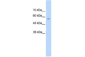 WB Suggested Anti-DDC Antibody Titration:  5. (DDC 抗体  (N-Term))